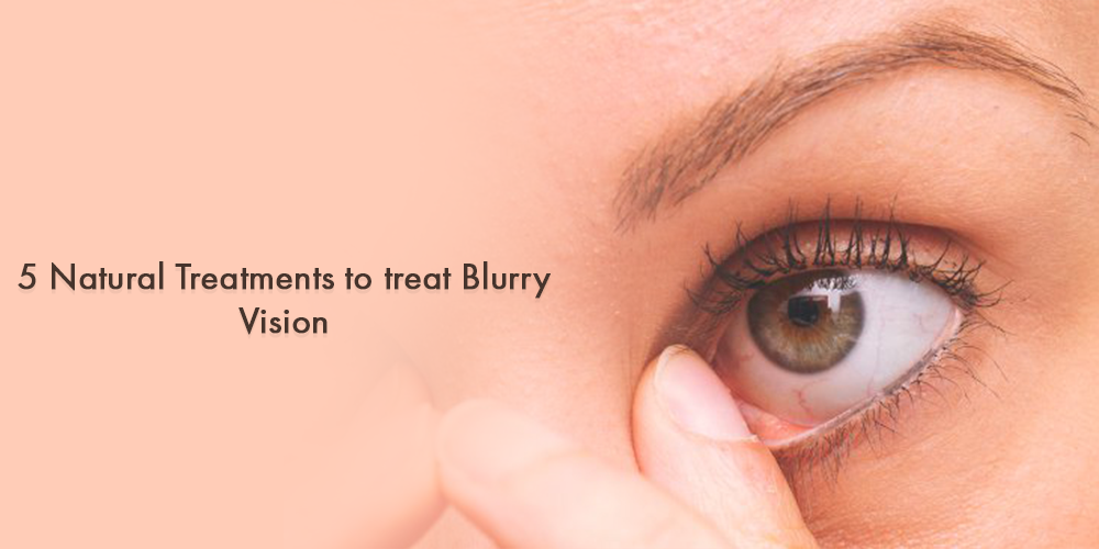 5 Natural Treatments to treat Blurry Vision