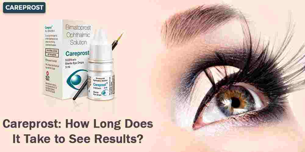 Careprost How Long Does It Take to See Results