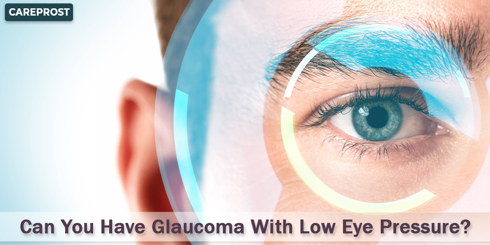 Can You Have Glaucoma With Low Eye Pressure