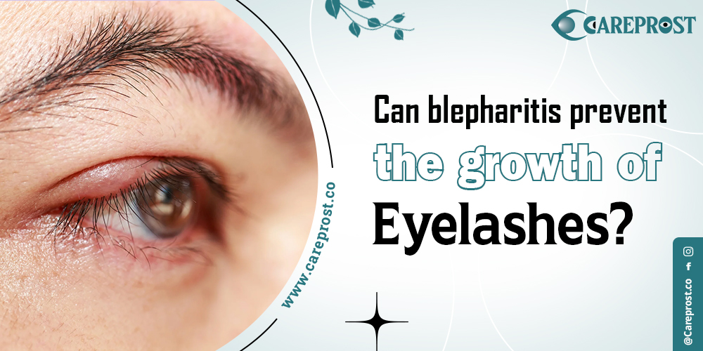 Can blepharitis prevent the growth of eyelashes?