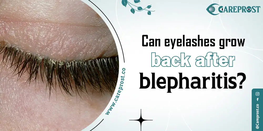Can eyelashes grow back after blepharitis?