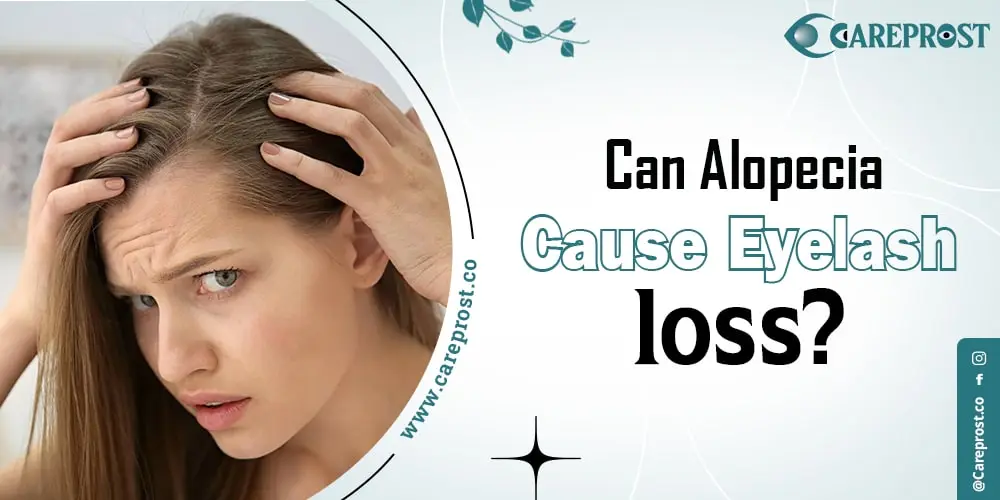 Can alopecia cause eyelash loss?